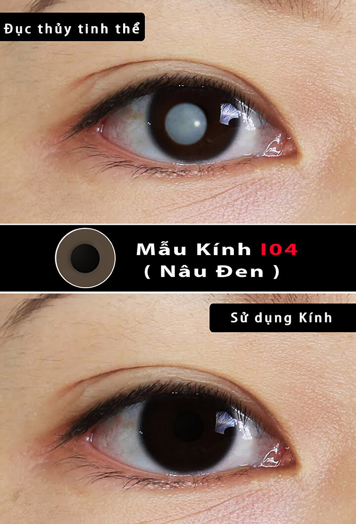 KÍNH ÁP TRÒNG THẨM MỸ- NÂU ĐEN I04
